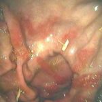 Horse stomach issues