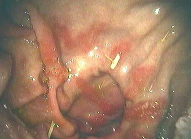 Horse stomach issues