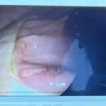 How Do I Know If My Horse Has Ulcers-