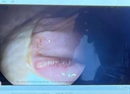 How Do I Know If My Horse Has Ulcers-