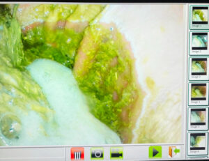 gastric ulcers in horses