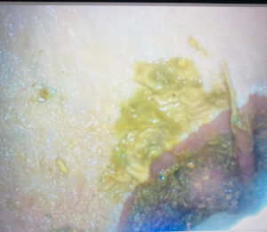 how to detect ulcers in horses at home