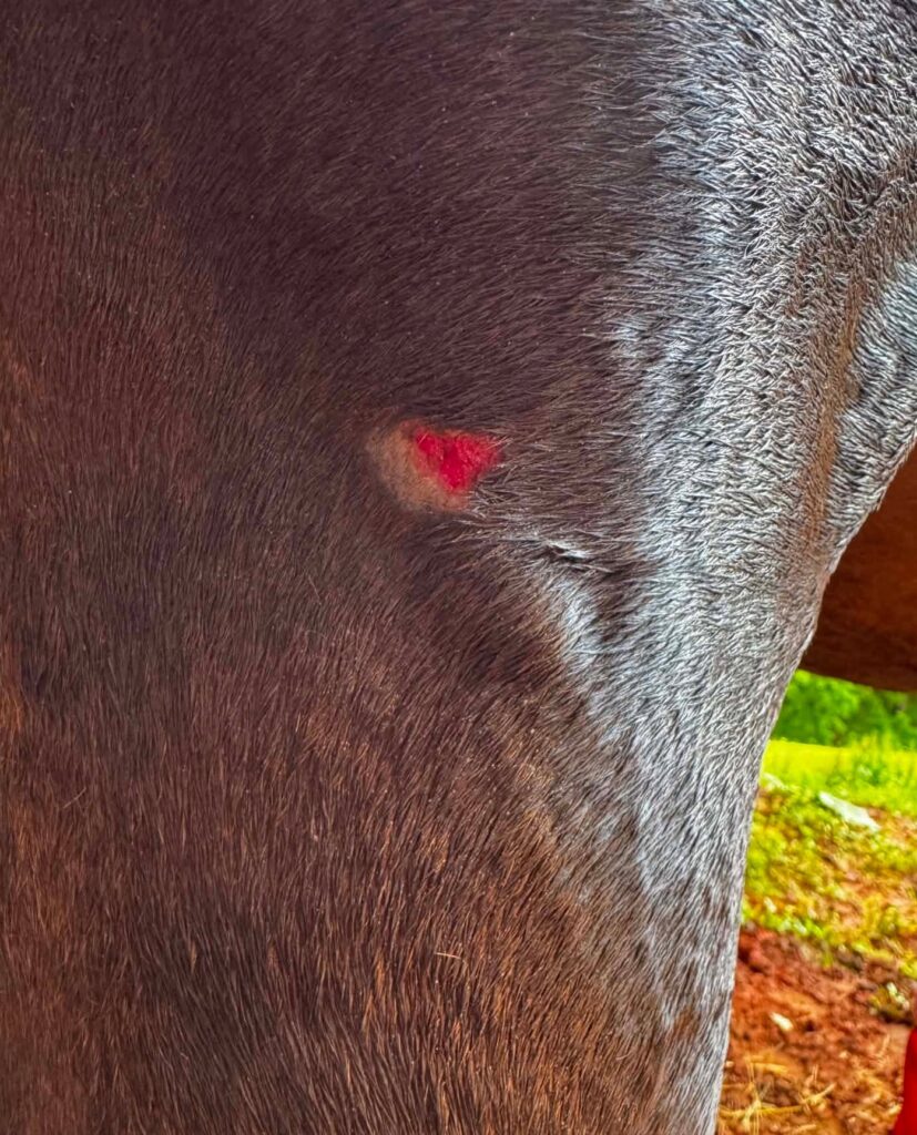 Are summer sores contagious